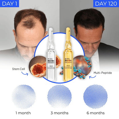 Hairlift Hair Regrowth System