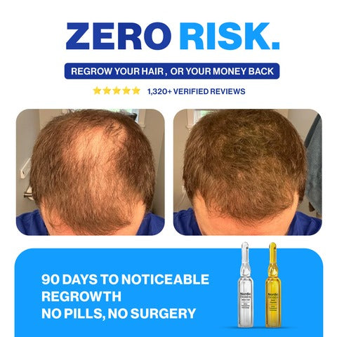 Hairlift Hair Regrowth System