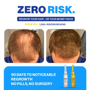 Hairlift Hair Regrowth System thumbnail 1